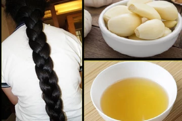 முடி கொட்டுவதை அடியோடு நீக்கனுமா? அப்போ பூண்டை இப்படி யூஸ் பண்ணுங்க போதும்!