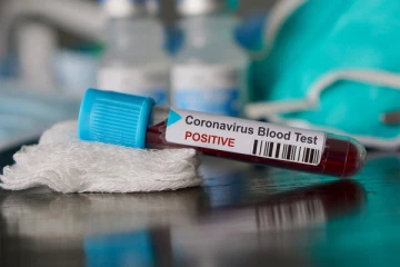 வவுனியாவில் 4 பேருக்கு கோவிட் தொற்று உறுதி