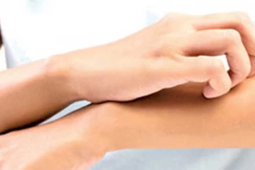 දරුවන් අතර පැතිර යන රෝගයක වැඩිවීමක් - රෝග ලක්ෂණ මෙන්න..