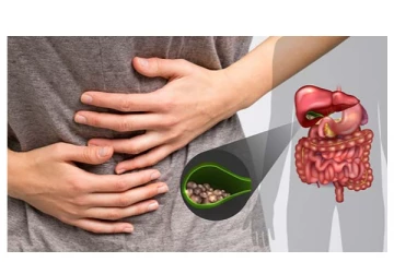 பித்தப்பை கல் ஆண்களை விட பெண்களுக்கு ஏன் அதிகமாக பாதிக்கிறது? அதன் அறிகுறிகளும், பக்கவிளைவுகளும்