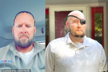 உலகின் முதல் கண் மாற்று அறுவை சிகிச்சை வெற்றி! அறிவியலின் அடுத்தக்கட்ட பாய்ச்சல்