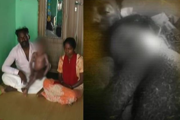 பாம்பு ஆன்மா விட்ட சாபமா? 8 வருடமாக பாம்பு போல் தோல் உரியும் சிறுவன் - நிலைகுறைந்து நிற்கும் பெற்றோர் - தமிழ்நாடு