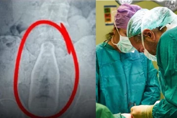 மாற்றுத் திறனாளியின் வயிற்றில் கண்ணாடி பாட்டில்; அதிர்ச்சி பின்னணி - மிரண்ட மருத்துவர்கள்!