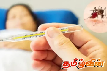 காய்ச்சல் இருந்தால் உடன் வைத்தியரை நாடுமாறு அறிவுறுத்தல்