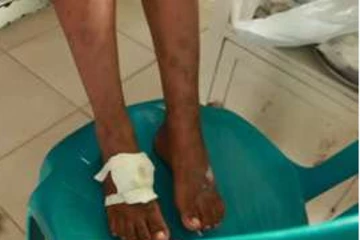 තම කුඩා දියණියට කෲර ලෙස වධ හිංසා කළ පාපතර දෙදරු මව