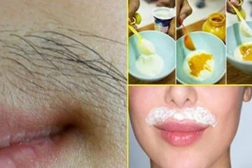 தேவையில்லாத முடிகளை நீக்க இதை மட்டும் செய்யுங்க