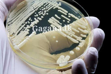 පැතිර යන භයානක දිලීරයක් - වෙන දේ ගැන වෛද්‍ය විශේෂඥන්ගෙන් අනතුරු ඇඟවීමක්..