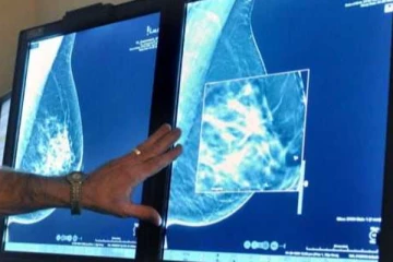 கனடாவில் மார்பகப்புற்று நோய் குறித்து முக்கிய அறிவிப்பு