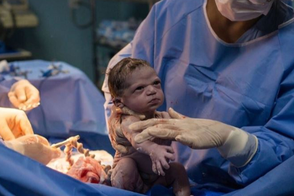 பிறந்த சிசுவின் தலையை வெட்டி தாயின் வயிற்றுக்குள்ளே வைத்த பகீர் சம்பவம்! பின்னணி என்ன? - தமிழ்நாடு