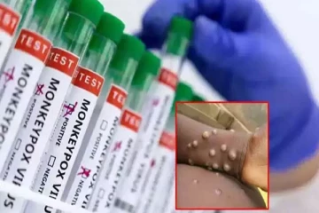 அச்சுறுத்தும் குரங்கு அம்மை..! பரவாமல் தடுக்கும் வழி - நாட்டு மக்களுக்கு எச்சரிக்கை
