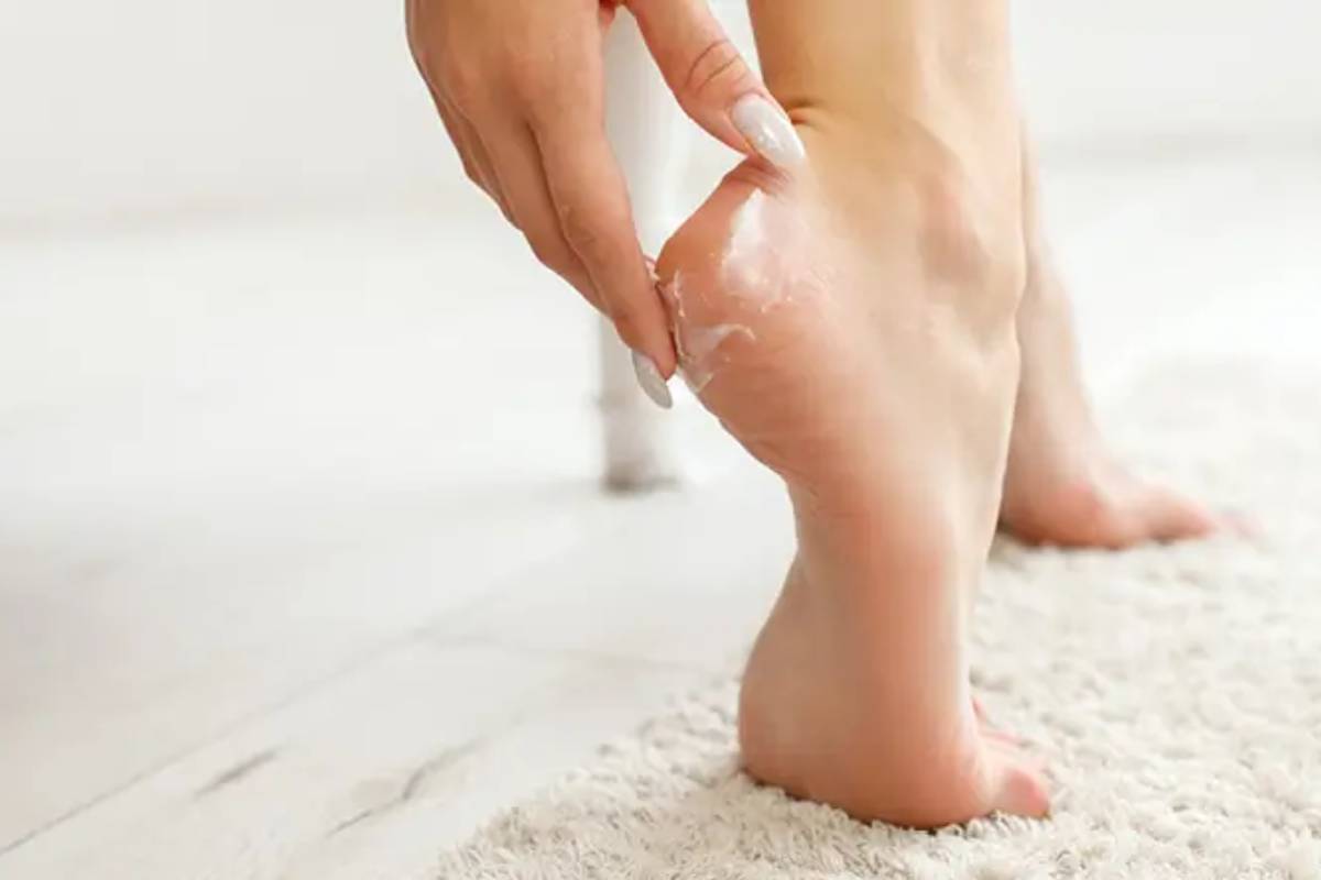 குதிகால் வெடிப்பை போக்க உதவும் இயற்கை வீட்டு வைத்தியம் | Home Remedies For Cracked Heels In Tamil குதிகால் வெடிப்பை போக்க உதவும் இயற்கை வீட்டு வைத்தியம் | Home Remedies For Cracked Heels In Tamil