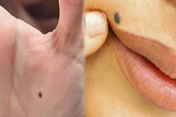 இந்த இடத்தில் மச்சம் இருந்தால் உங்களிடம் பணம் நிரம்பி வழியுமாம்!