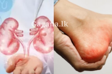 දැනගෙන හිටිය ද දියවැඩියාව තියෙනවා නම් මේ දෙය හැමදාම කරන්නම ඕන කියලා..