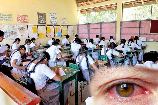 பாடசாலை மாணவர்களிடையே அதிகளவில் பரவும் நோய்; பெற்றோர்களுக்கு எச்சரிக்கை! | High Incidence Of Disease Among School Children