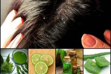 பொடுகு தொல்லையை அடியோடு விரட்டணுமா?