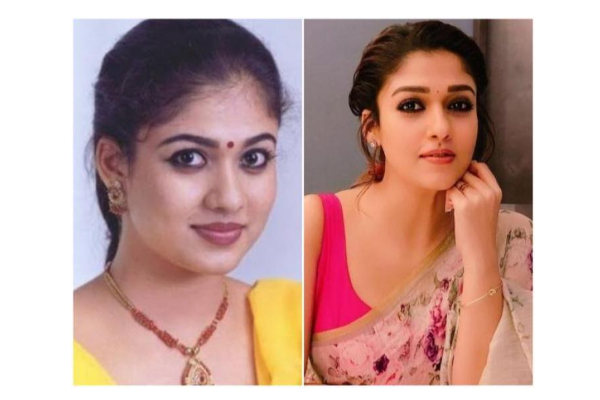 அழகுக்காக அறுவை சிகிச்சை செய்துகொண்ட பிரபல தமிழ் நடிகைகள் ! | Tamil Actress Cosmetic Surgery List