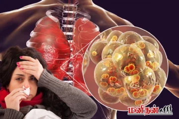 நாள்பட்ட நுரையீரல் சளியை கரைத்து வெளியேற்றும் உணவுகள்