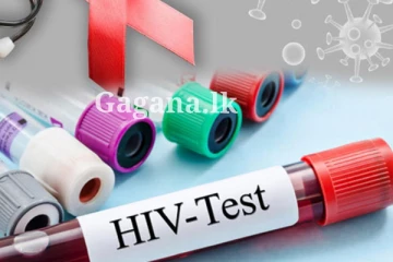විදේශගතව සිට මෙරටට පැමිණි දෙදෙනෙක්ට HIV ආසාදනය වෙලා..