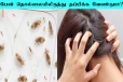 பேன் தொல்லையிலிருந்து தப்பிக்க வேண்டுமா? இதை மட்டும் செய்தால் போதும்
