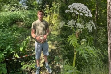 லண்டனிலுள்ள பூங்கா ஒன்றில் காலில் பட்ட விஷச் செடியால் நேர்ந்த நிலை!