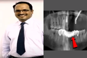 ஒரே ஒரு பல் தான் ஆடிச்சு ..மொத்த பல்லையும் பிடுங்கி பல் டாக்டர்..!!