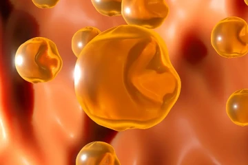 எச்சரிக்கை... கொலஸ்ட்ரால் அதிகமானால் இந்த ஒரு பாகத்தில் திடீர் மாற்றம் தெரியும்!