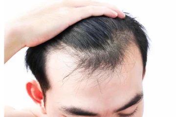 கொட்டுன இடத்தில் முடி வேக வேகமாக அடர்த்தியா வளர இந்த ஒரே ஒரு பொருள் போதும்!