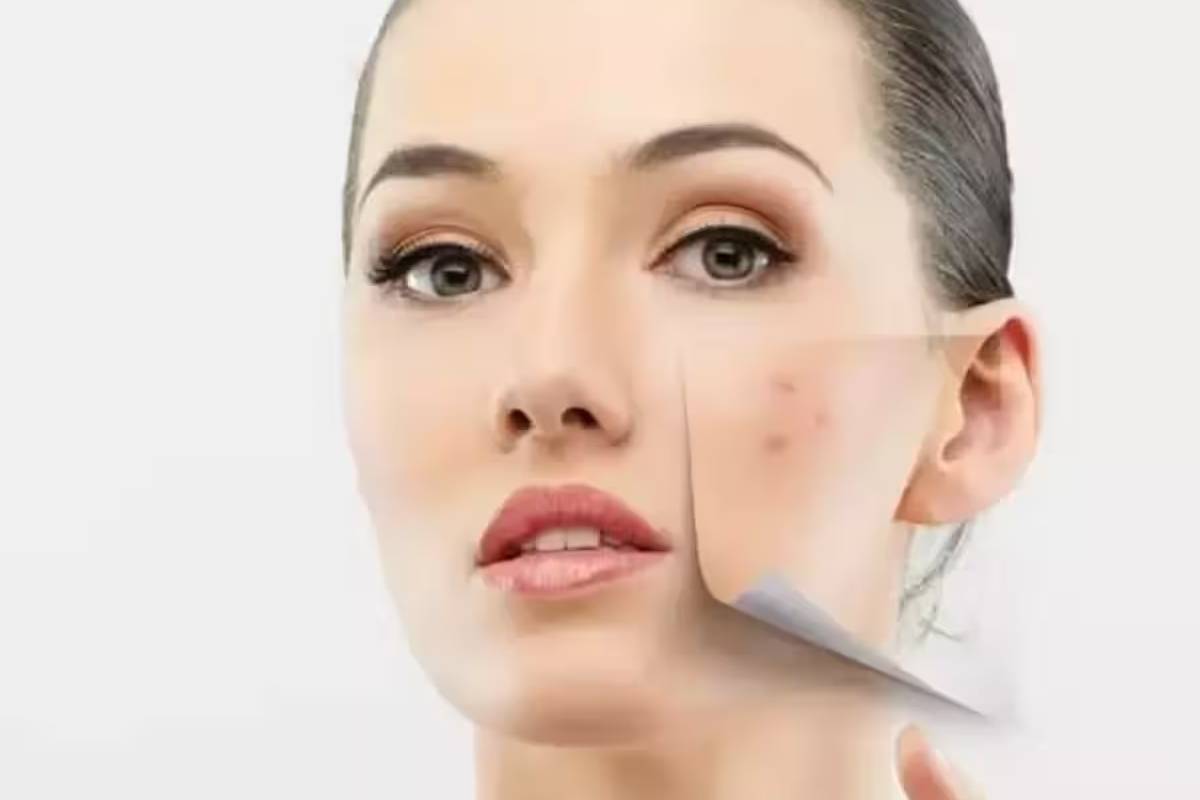 Skincare Tips : முகத்தில் உள்ள கரும்புள்ளிகளை குறைக்க எளிய இயற்கை வழிகள்! | Best Home Remedy For Black Heads From Your Face Skincare Tips : முகத்தில் உள்ள கரும்புள்ளிகளை குறைக்க எளிய இயற்கை வழிகள்! | Best Home Remedy For Black Heads From Your Face