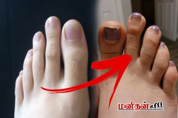 காலில் கட்டை விரலை விட இரண்டாவது விரல் நீளமா இருக்கா? அப்போ இது உண்மை தான்