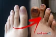 காலில் கட்டை விரலை விட இரண்டாவது விரல் நீளமா இருக்கா? அப்போ இது உண்மை தான்