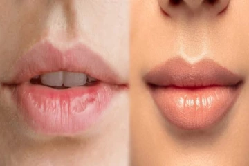 உலர்ந்த உதடுகளை மென்மையாக மாற்ற வேண்டுமா? இதோ எளிமையான வீட்டு வைத்தியம்