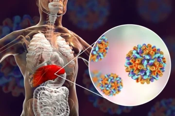 அமெரிக்காவை அச்சுறுத்தும் மற்றொரு மர்ம நோய்!