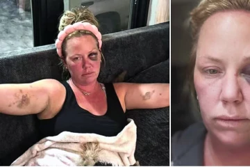 கியூபாவில் விடுமுறையைக் கொண்டாட சென்ற பெண்ணுக்கு நேர்ந்த அனர்த்தம்