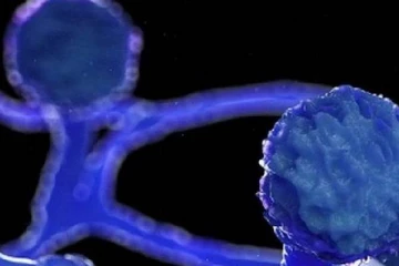 கரும் பூஞ்சை நோயினால் இலங்கையில்  பதிவான முதலாவது மரணம்