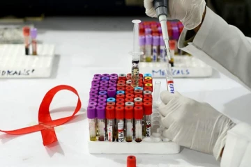 உயிரணுக்களில் இருந்து HIV ஐ வெற்றிகரமாக அகற்ற முடியும்; விஞ்ஞானிகள் நம்பிக்கை