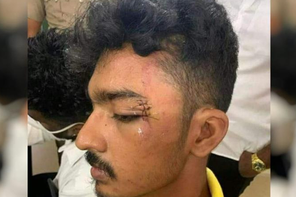 மாணவன் அப்துல் ரஹீம் தாக்கப்பட்ட விவகாரம் 9 போலீசார் மீது வழக்குப்பதிவு - தமிழ்நாடு