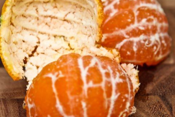 யாருக்கெல்லாம் ஆரஞ்சு பிடிக்கும்! அதிகமாக சாப்பிட்டால் இவ்வளவு பக்க விளைவுகளா? | Side Effect Of Eating Too Many Oranges