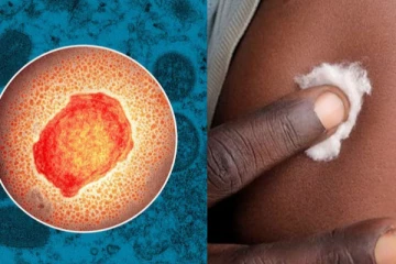 குரங்கம்மை எப்படி பரவுகின்றது? அதன் அறிகுறிகள் என்ன? கட்டாயம் தெரிஞ்சிகோங்க