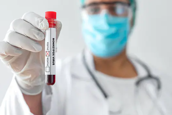ஆசியாவில் குரங்கு அம்மையால் முதல் மரணம் பதிவானது | First Monkey Measles Death Reported In Asia