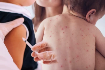 குழந்தைகள் மத்தியில் வேகமாக பரவும் நோய்: வெளியான காரணம்