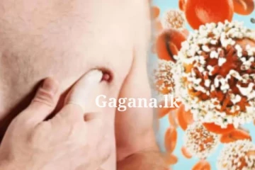 පියයුරු පිළිකා පිරිමි පුද්ගලයින් අතරත් වැළඳීමේ වැඩි අවදානමක්...