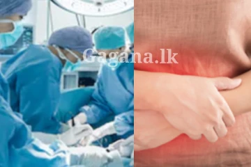 මොකක්ද මේ කතකගේ ගර්භාෂයේ බරටම තිබ්බ කිලෝ 15 - කාන්තා ඔබටත් විශේෂ දැනුම්දීමක් මෙන්න..