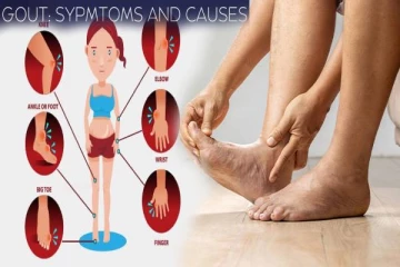 gout symptoms : கீல்வாதம் ஆபத்தான நோயா? அறிகுறிகளும் சிகிச்சைகளும்