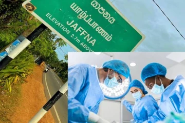 யாழில் நுளம்புக்கு புகைப் போட்டுக் கொண்டிருந்த நபருக்கு நடந்த அதிர்ச்சி சம்பவம்!