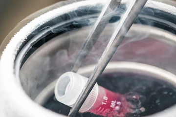 கருமுட்டையை உறைய வைக்கும் முறையை யாரெல்லாம் பயன்படுத்திக்கொள்ளலாம்? எச்சரிக்கை