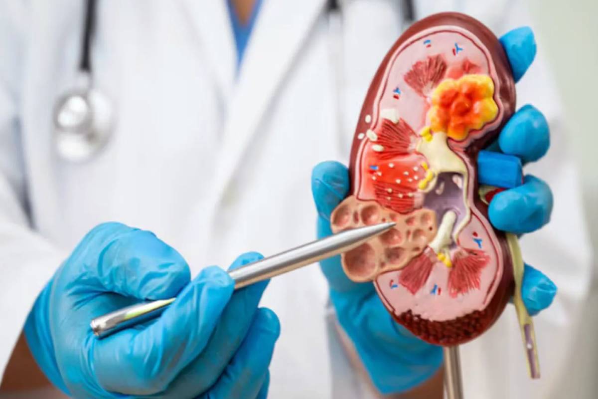 இந்த இரண்டு பிரச்சனை இருக்கா? அப்போ பீட்டூட் பச்சையாக சாப்பிட கூடாது | Benefits Of Eating Raw Beetroot இந்த இரண்டு பிரச்சனை இருக்கா? அப்போ பீட்டூட் பச்சையாக சாப்பிட கூடாது | Benefits Of Eating Raw Beetroot