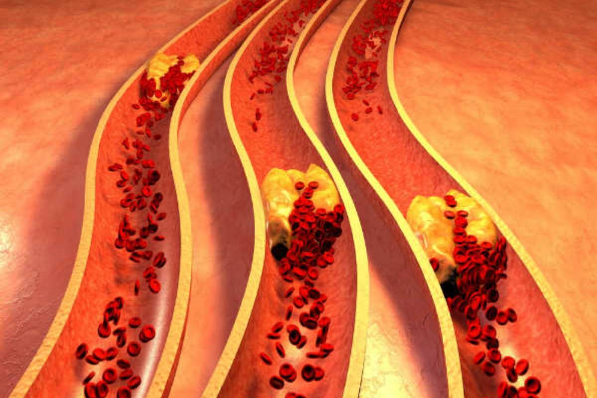 கோடை காலத்தில் சியா விதைகள் தண்ணீரை குடித்தால் என்ன பயன்? | Drink Chia Seed Water In Summer Benefits Right Way