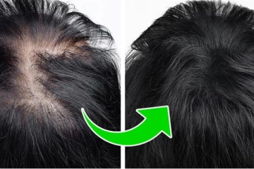 தலையில அடர்த்தியா முடி வளரணுமா? இந்த சக்திவாய்ந்த விதைய எண்ணெயில போட்டு தேய்ங்க!