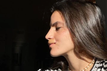 நாய் தாக்கியதில் உதடுகளை இழந்த மாடல் அழகி பகிர்ந்த புகைப்படங்கள்!