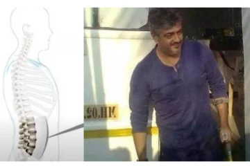 அஜித்துக்கு முதுகெலும்பில் எலும்பை நீக்கிய மருத்துவர்கள்? வெளியான தகவல்